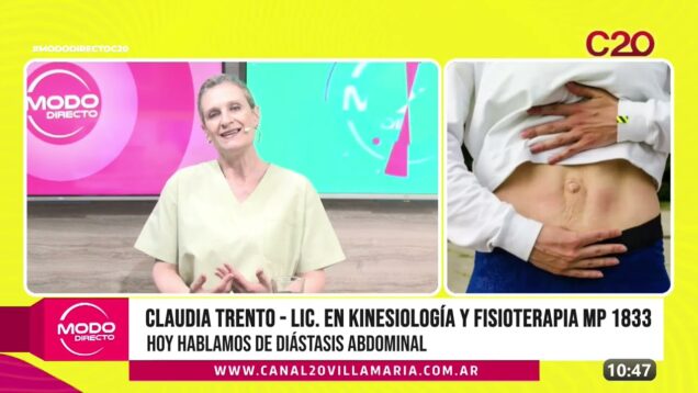 Modo Directo | Diástasis Abdominal – Claudia Trento