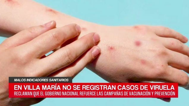 C20 Noticias | Malos indicadores sanitarios parte2 – Julián López