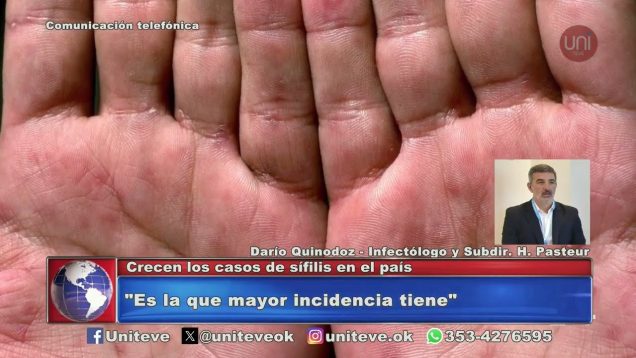 Uniteve Noticias | Crecen los casos de sifilis en el país